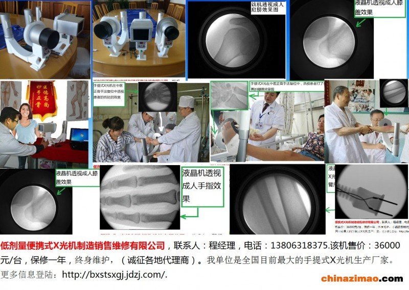 1-便携式X光机-组图-1