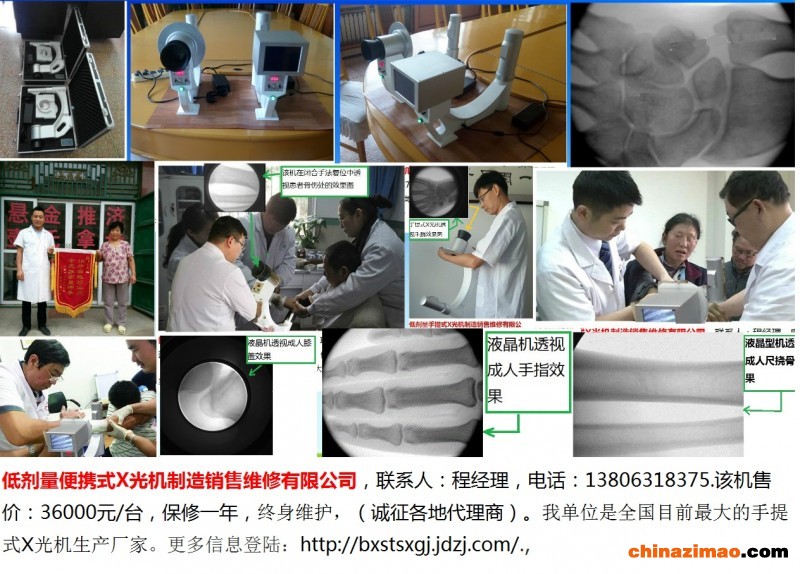 1-便携式X光机-组图-5